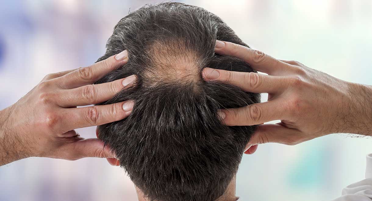 Hair Loss Dr Sandra Cabot MD