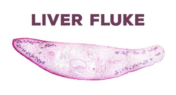 Liver Fluke - Dr Sandra Cabot MD