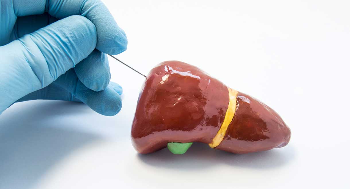 Liver Biopsy Dr Sandra Cabot MD