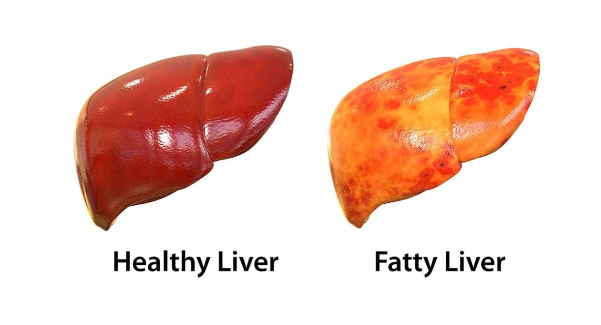 How Healthy Is Your Liver? Dr Sandra Cabot MD
